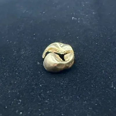 High Karat Dental Scrap Gold - Tests 22k+