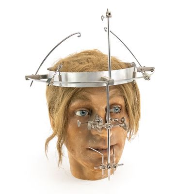 Sale Photo Thumbnail #148: Vintage Wax Head & Surgical Halo Set