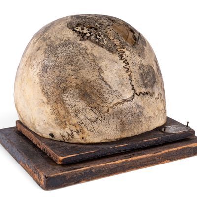 19th C Medical Cranium Specimen