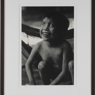 Sale Photo Thumbnail #148: Valdir Cruz, Brazilian 1954-, Young Girl with Onchocirciassis, Gelatin Silver Print, Selenium Toned